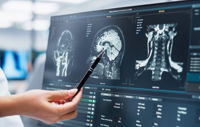 traumi cranio-encefalici